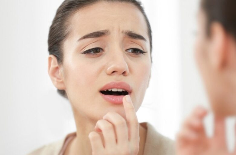 Bibir Anda Berwarna Hitam? Bagaimana Menghilangkannya?